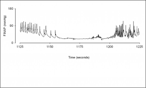 Figure 2 Continuous blood pressure recordings during 50 seconds of asystole. Time (seconds) is taken from the original recording.