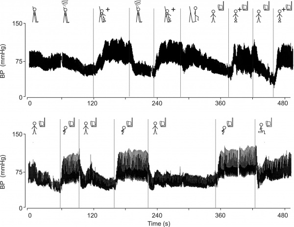 Fig 1. Continuous blood pressure recordings during manoeuvres (see text).